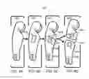 Fig. 05 - 3D printed pin and void systems and methods