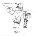 Fig. 04 - Method for manufacturing a leak tight porous component