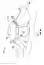 Fig. 07 - Joining arrangement and method with molded stake and aperture