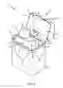 Fig. 02 - CONTAINER SYSTEM