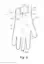 Fig. 12 - Readily manually accessible disposable gloves