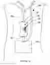 Fig. 16 - Dispenser apparatus and method of using same