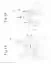 Fig. 08 - FILTER-BAG FOR INFUSION PRODUCTS AND METHOD FOR MAKING FILTER-BAG