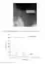 Fig. 08 - Method for Preparing a Mesoporous Material, Material Obtained Thereof and Use