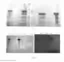 Fig. 02 - Method for isolating and purifying recombinant human serum albumin from transgenic rice grain