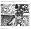 Fig. 22 - Compositions and methods for preventing or treating diseases, conditions or processes characterized by aberrant fibroblast proliferation and extracellular matrix deposition