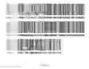 Fig. 03 - Methods for treating ulcers in a hemoglobinopathy anemia with a soluble actRIIB polypeptide