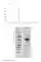 Fig. 04 - Methods for treating ulcers in a hemoglobinopathy anemia with a soluble actRIIB polypeptide
