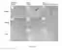 Fig. 45 - Methods for treating ulcers in a hemoglobinopathy anemia with a soluble actRIIB polypeptide