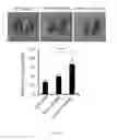 Fig. 07 - METHOD FOR TREATING CANCER METASTASIS AND COMPOSITION THEREOF