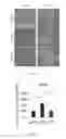 Fig. 09 - METHOD FOR TREATING CANCER METASTASIS AND COMPOSITION THEREOF