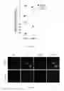 Fig. 16 - METHOD FOR TREATING CANCER METASTASIS AND COMPOSITION THEREOF