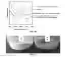 Fig. 05 - Coagulation of chitin from ionic liquid solutions using kosmotropic salts