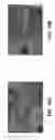 Fig. 09 - Sol-gel coating compositions including corrosion inhibitor-encapsulated layered metal phosphates and related processes