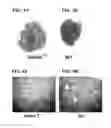 Fig. 03 - Therapeutic agent for a lung disease and/or method for screening for the same