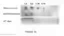 Fig. 12 - Transgenic microalgae and use thereof as a feed for delivery of interfering RNA molecules