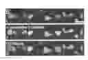 Fig. 01 - Methods of treating brain edema
