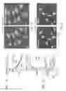 Fig. 06 - Methods of treating brain edema