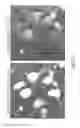 Fig. 08 - Methods of treating brain edema