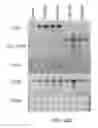 Fig. 32 - Transgenic legumes
