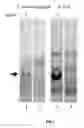 Fig. 08 - THERMOPHILIC MICROORGANISMS FOR CONVERSION OF LIGNOCELLULOSIC BIOMASS TO ETHANOL