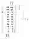 Fig. 04 - Methods and compositions for reducing redundant molecular barcodes created in primer extension reactions