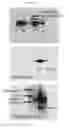 Fig. 43 - Compositions and methods for determining genetic polymorphisms in the TMEM216 gene