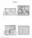 Fig. 02 - Bicomponent spandex