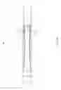 Fig. 09 - High flow downhole lock