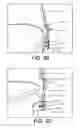 Fig. 07 - Clip for use with a cooking device