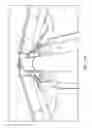 Fig. 10 - Quick release tensioning device