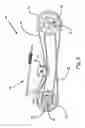 Fig. 03 - Belt drive system