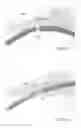 Fig. 08 - Seal rings and methods for making them