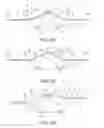 Fig. 07 - SUPPORT DEVICE FOR AT LEAST ONE PORTION OF A LINEAR STRUCTURE FOR CROSSING AN UNEVEN UNDERWATER TOPOGRAPHY, ASSEMBLY COMPRISING SAID DEVICE AND METHOD OF SUPPORT