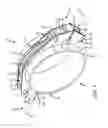 Fig. 02 - Restraint device