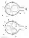 Fig. 06 - Multi-layered gas-filled bladder for accommodating changes in fluid characteristics within a fluid delivery system