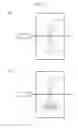 Fig. 10 - Light detection device