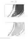 Fig. 67 - Infrared analysis of benign tumors