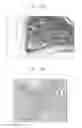 Fig. 69 - Infrared analysis of benign tumors