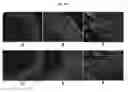 Fig. 07 - Engineered Three-Dimensional Breast Tissue, Adipose Tissue, and Tumor Disease Model