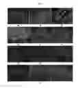 Fig. 09 - Engineered Three-Dimensional Breast Tissue, Adipose Tissue, and Tumor Disease Model