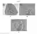 Fig. 28 - Engineered Three-Dimensional Breast Tissue, Adipose Tissue, and Tumor Disease Model