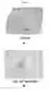 Fig. 33 - Engineered Three-Dimensional Breast Tissue, Adipose Tissue, and Tumor Disease Model