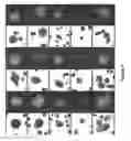 Fig. 07 - METHODS FOR DETECTION OF CIRCULATING TUMOR CELLS AND METHODS OF DIAGNOSIS OF CANCER IN A MAMMALIAN SUBJECT