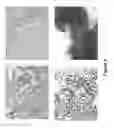 Fig. 09 - METHODS FOR DETECTION OF CIRCULATING TUMOR CELLS AND METHODS OF DIAGNOSIS OF CANCER IN A MAMMALIAN SUBJECT