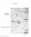 Fig. 04 - Method of evaluating cellulite and method of evaluating cellulite-effective drug using fibulin-3 and/or sarcoglycan gamma as an indicator