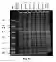 Fig. 19 - Methods of using antibodies to determine periostin levels in a sample
