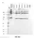 Fig. 20 - Methods of using antibodies to determine periostin levels in a sample