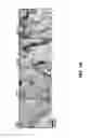 Fig. 02 - Detection of Misfolded Amyloid Beta Protein