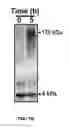 Fig. 03 - Detection of Misfolded Amyloid Beta Protein